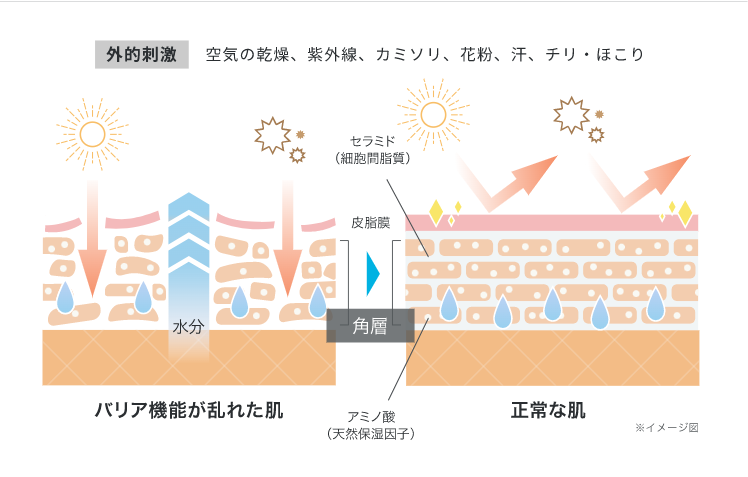 乾燥肌(ドライスキン)になるメカニズム
