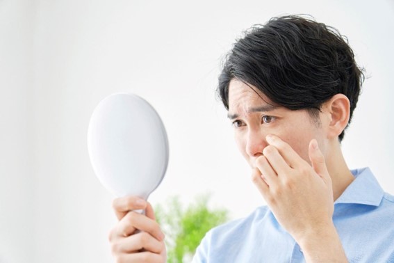 角栓を除去するおすすめの方法は？なるべく避けたいNG方法も解説