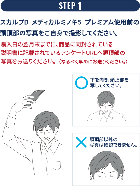 STEP 1 スカルプD  メディカルミノキ５  プレミアム使用前の頭頂部の写真をご自身で撮影してください。