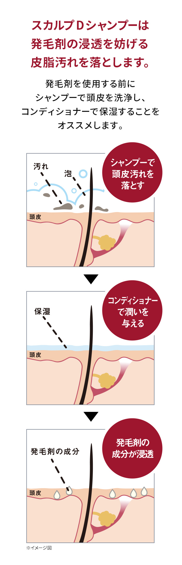 スカルプDシャンプーは発毛剤の浸透を妨げる皮脂汚れを落とします。発毛剤を使用する前にシャンプーで頭皮を洗浄し、コンディショナーで保湿することをオススメします。