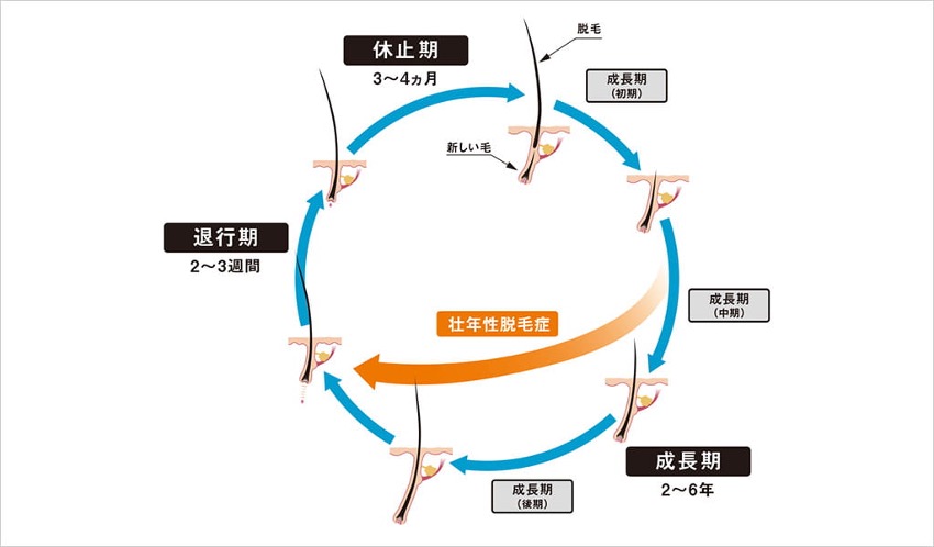 アンファーおすすめの抜け毛に効く運動