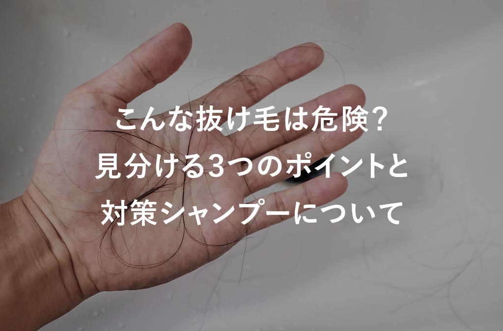 こんな抜け毛は危険のサイン？ 抜け毛を見分ける3つのポイントは？