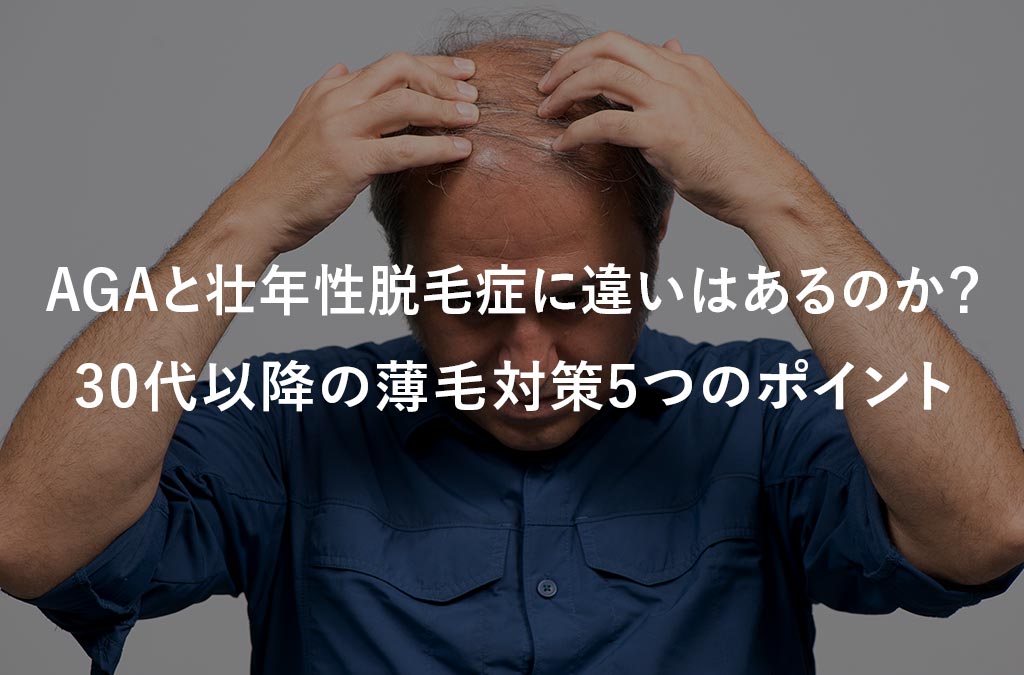 AGAと壮年性脱毛症に違いはあるのか？30代以降の薄毛対策5つのポイント