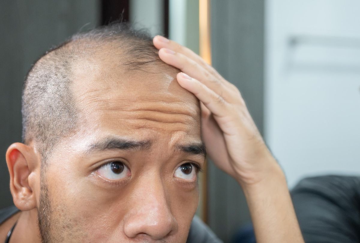 【毛髪診断士監修】頭皮が脂性でべたつく…乾燥肌との見分け方は？脂性肌の原因と改善方法