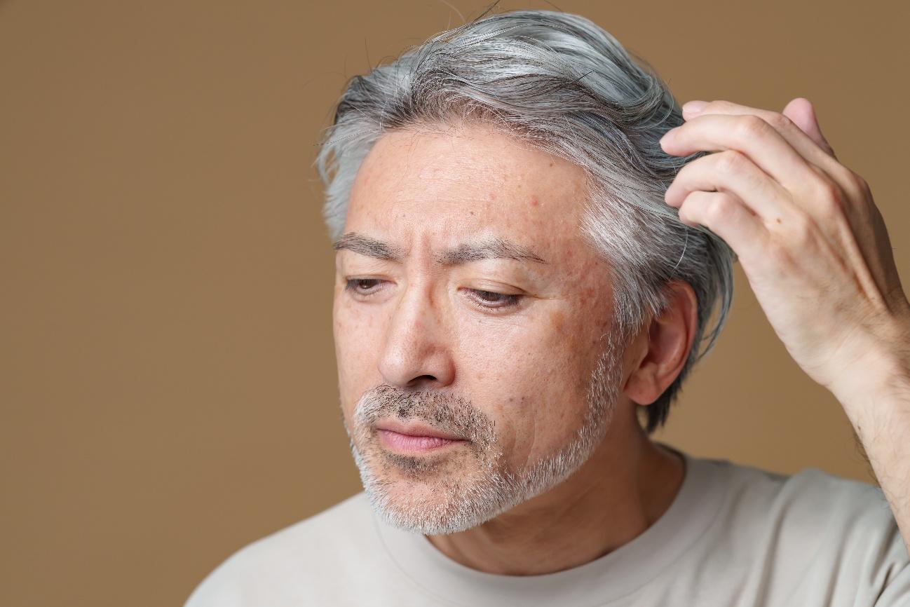 白髪の原因となる体内メカニズム