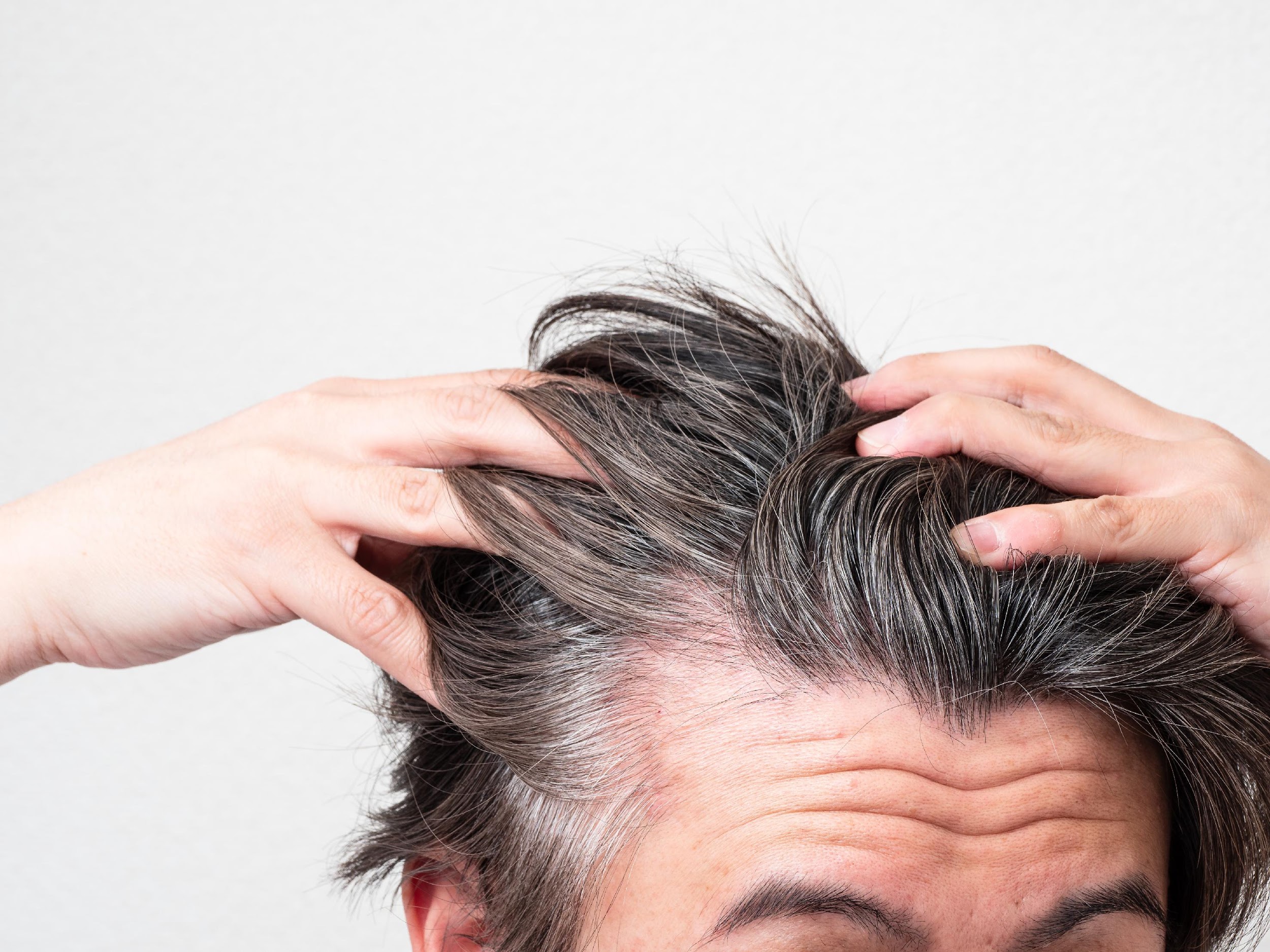 白髪の主な発生場所と関連する原因