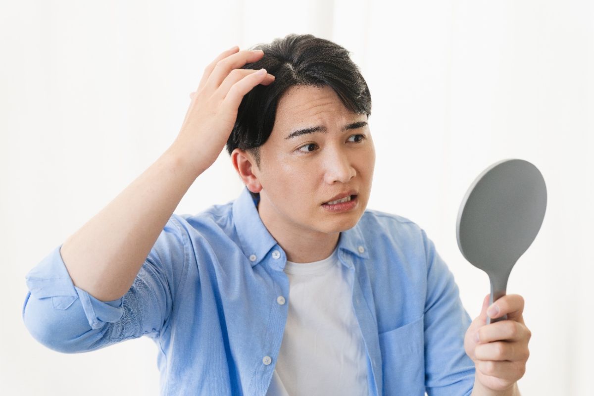 頭皮湿疹の主な自覚症状