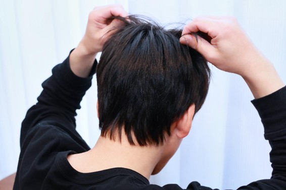 【毛髪診断士監修】頭皮も老化するって本当？老化すると起こる頭皮トラブル・対策方法も紹介