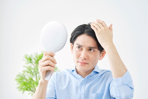 【毛髪診断士監修】頭皮の汚れが薄毛につながる？汚れの種類や落とし方、予防方法を紹介