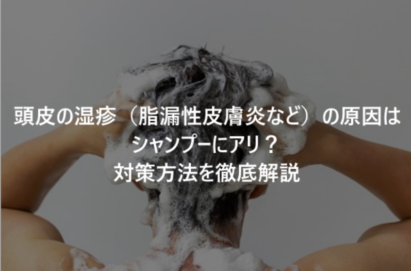【毛髪診断士監修】頭皮の湿疹（脂漏性皮膚炎、炎症など）の原因はシャンプーにアリ？対策方法を徹底解説