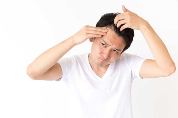 【毛髪診断士監修】頭皮が痛い原因は？病気の可能性やピリピリ・赤いなど症状別の理由を紹介