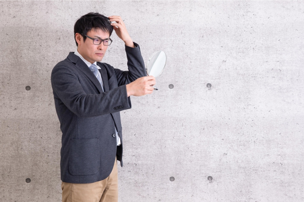 【毛髪診断士監修】頭皮の白いかさぶたの正体・原因は？ケア方法と治らないときの対処方法