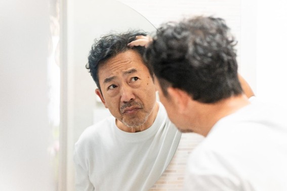 脂漏性皮膚炎の注意点